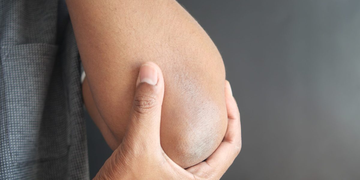 man with elbow pain. Pain relief concept
